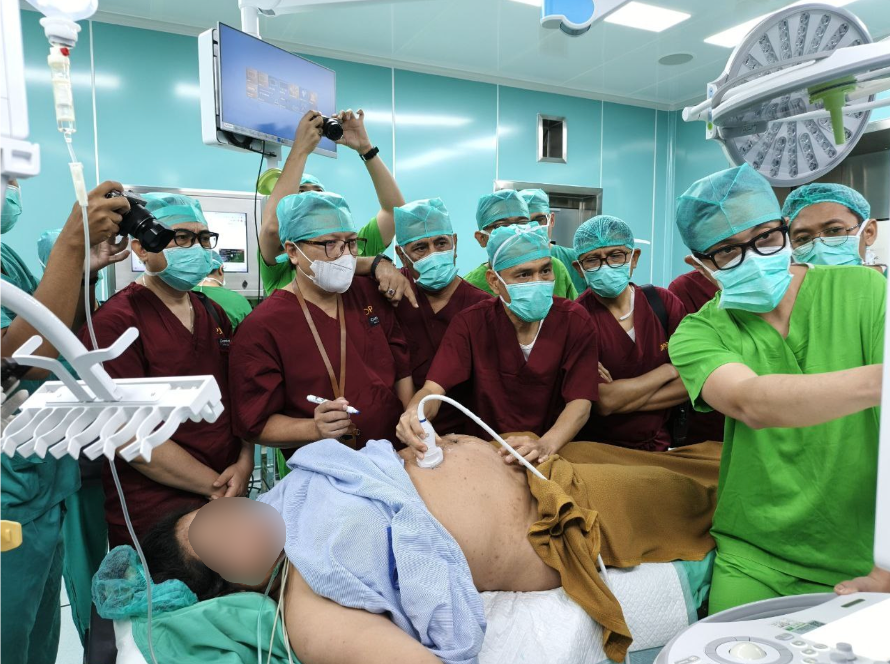 Tonggak Baru Layanan Kedokteran Janin: Laser Fetoscopy untuk TTTS Stadium III di RSUP Ngoerah