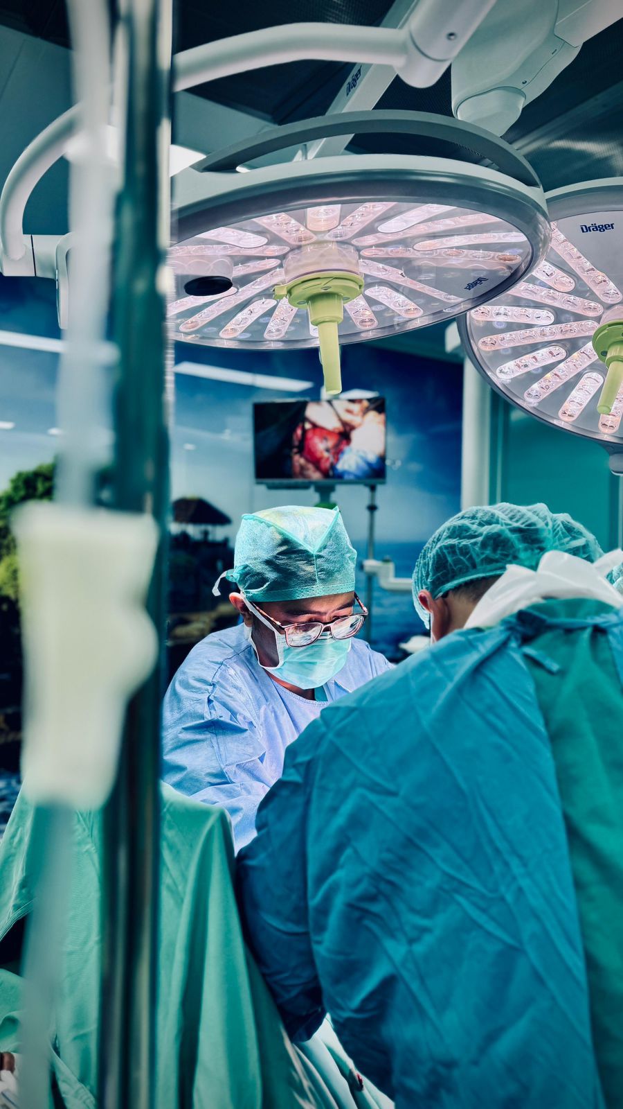 Tim PPDS-2 Obgin Udayana bidang Fertilitas, Endokrinologi, dan Reproduksi bekerja dengan penuh ketelitian dan koordinasi tinggi di ruang operasi. Setiap tindakan merupakan wujud komitmen terhadap keselamatan pasien dan keunggulan akademik.